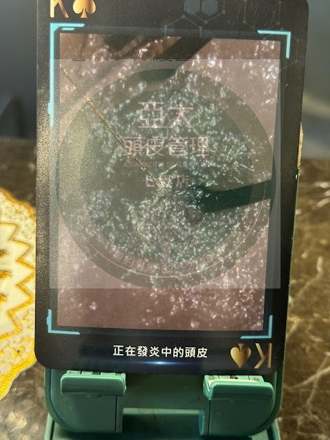 亞太頭皮管理-七賢店改善落髮
